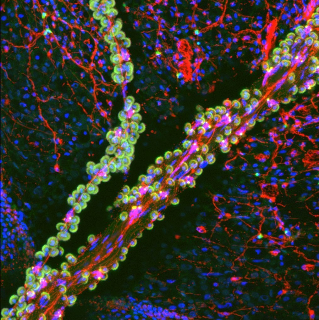 Confocal micrograph of a tentacle of a juvenile Florida Pleurobrachia ctenophore stained for filamentous actin (green) and neurons (red)