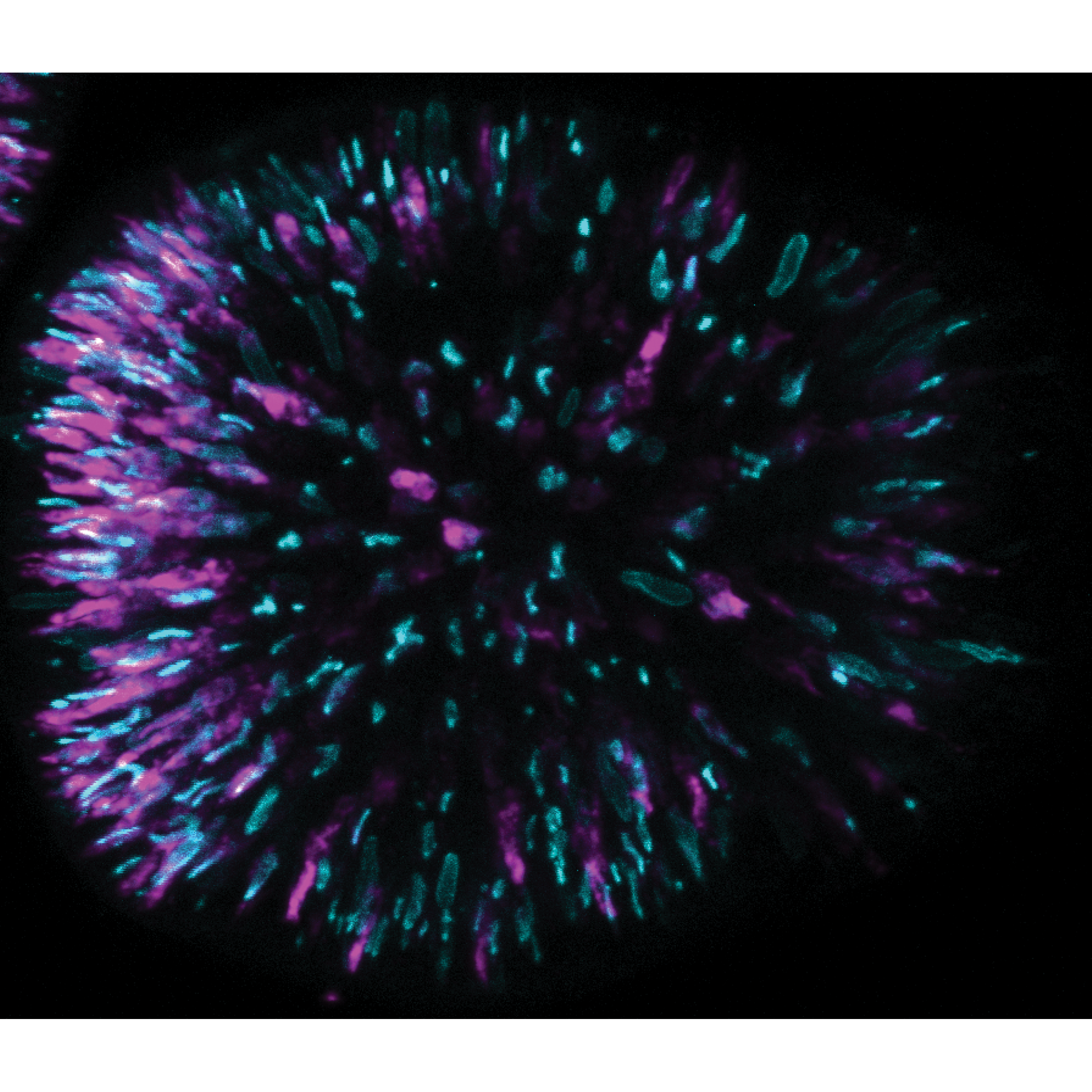 Developing stinging cells (magenta and aqua) in a larva of the sea anemone Nematostella vectensis