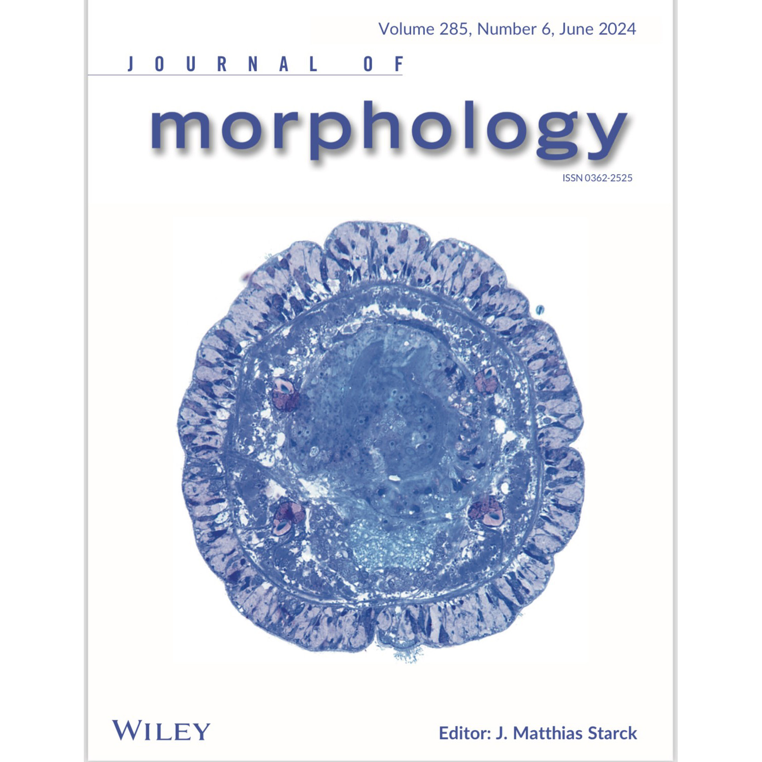 Seaver Lab Paper selected for Cover Image