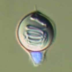 Cnidocyte