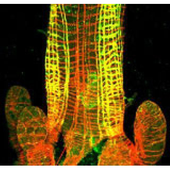 Mosquito larvae under a microscope